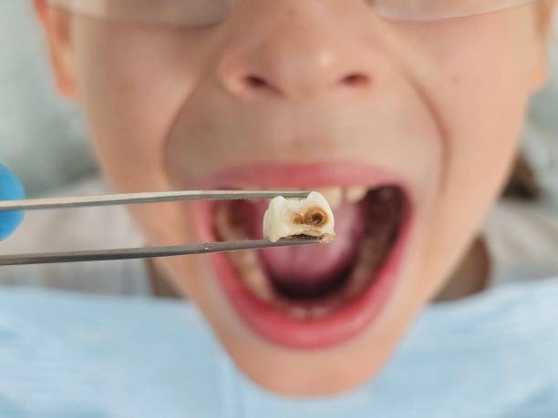 Best Emergency Pediatric Dental Care in Berrien Springs, MI